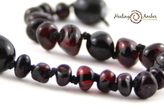 Healing Amber Polished Necklace - 11"-Mountain Baby