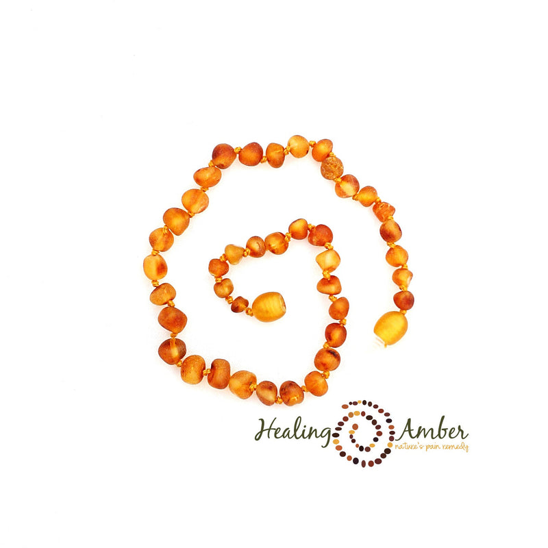 Healing Amber Raw Necklace - 11"-Mountain Baby