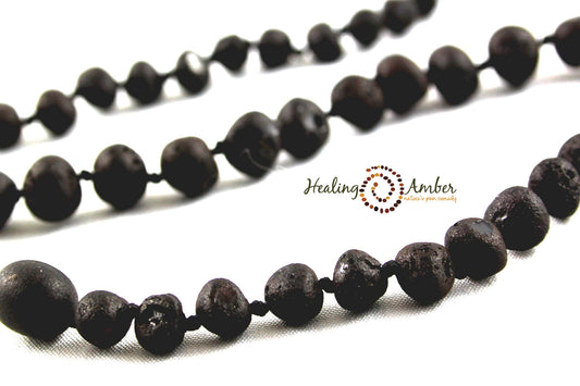 Healing Amber Raw Necklace - 11"-Mountain Baby