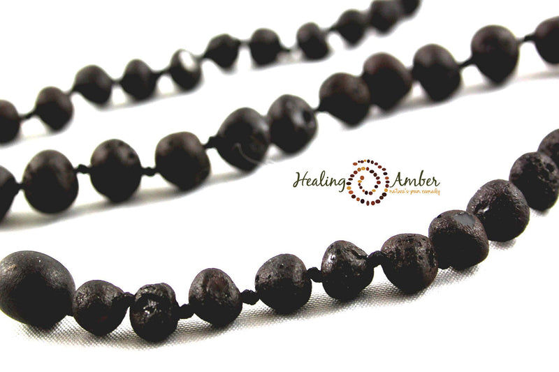 Healing Amber Raw Necklace - 11"-Mountain Baby