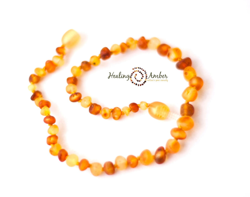 Healing Amber Raw Necklace - 11"-Mountain Baby