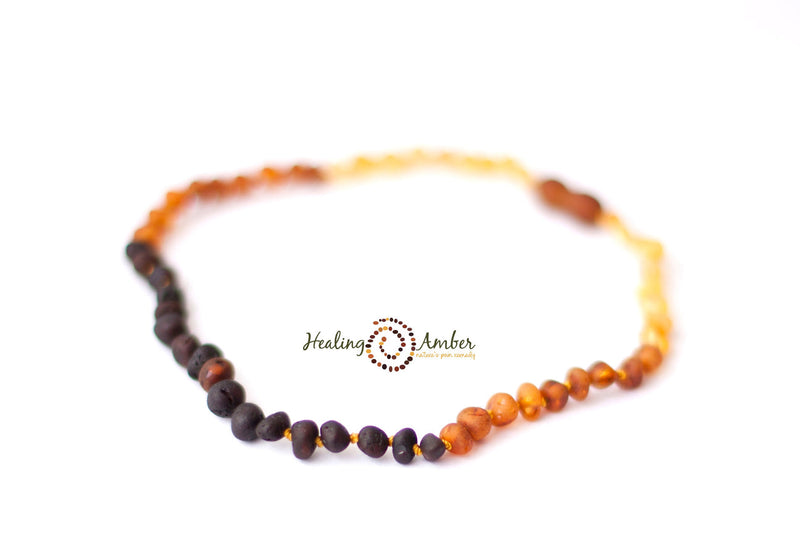 Healing Amber Raw Necklace - 11"-Mountain Baby