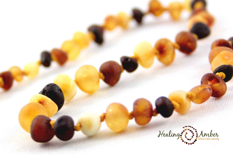 Healing Amber Raw Necklace - 11"-Mountain Baby